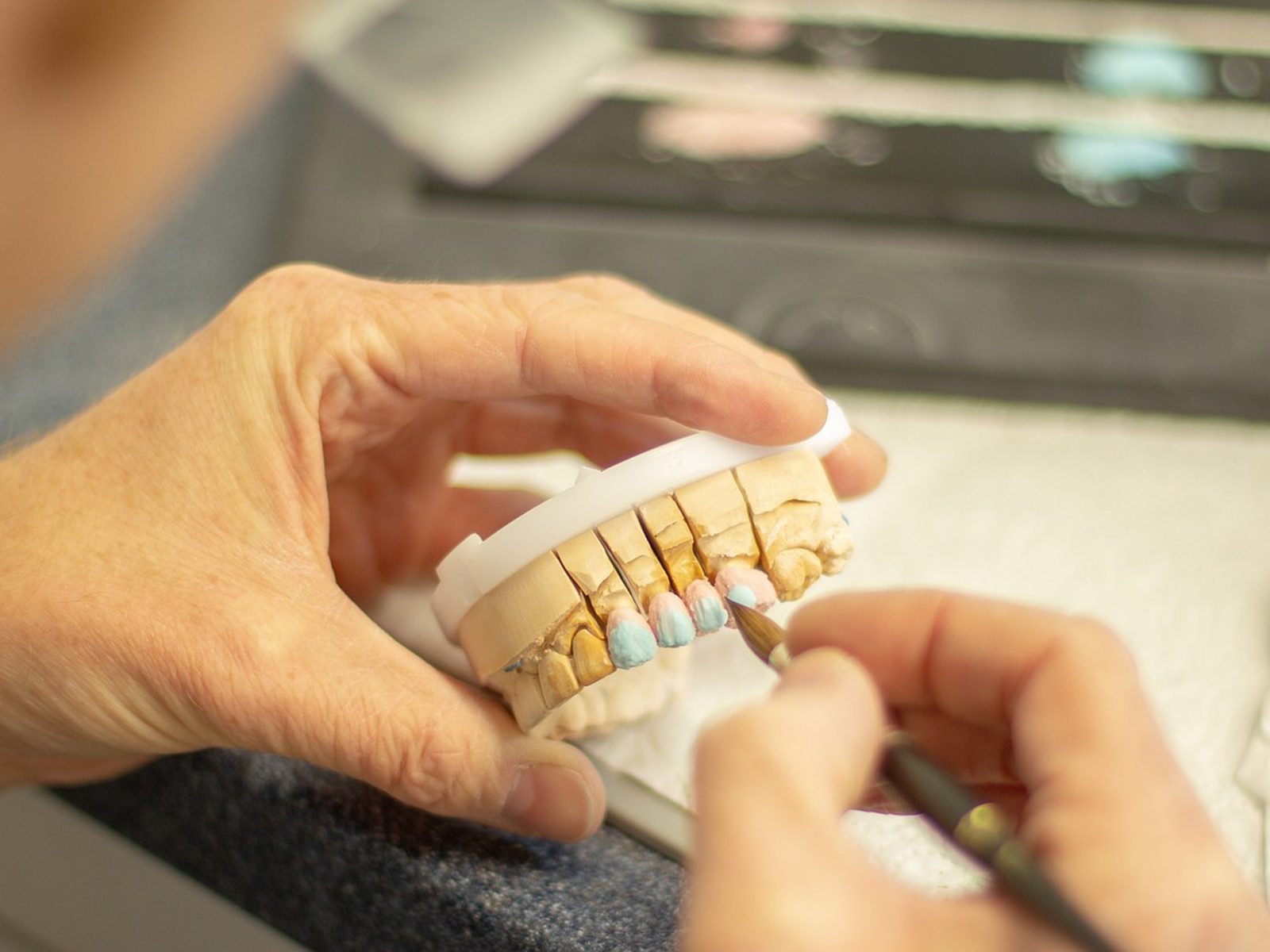 Cerámicas y estética dental